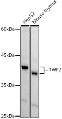 Western Blot: TWF2 Antibody [NBP2-94579] - Western blot analysis of extracts of various cell lines, using TWF2 antibody (NBP2-94579) at 1:1000 dilution. Secondary antibody: HRP Goat Anti-Rabbit IgG (H+L) at 1:10000 dilution. Lysates/proteins: 25ug per lane. Blocking buffer: 3% nonfat dry milk in TBST. Detection: ECL Basic Kit. Exposure time: 45s.